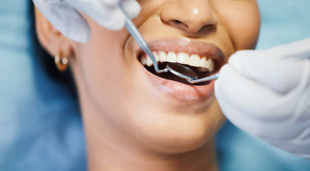 Best Emergency Dentist for Knocked-Out Tooth in Angels, CA