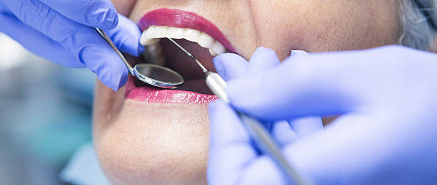 Best Weekend Emergency Dentist in Angels, CA