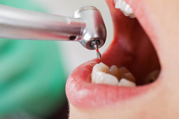 Best Emergency Cosmetic Dentistry in Angels, CA